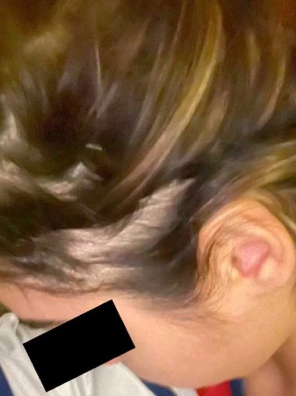 Side hairline before consistent use