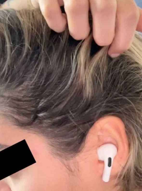 Side hairline after 3 months of consistent use