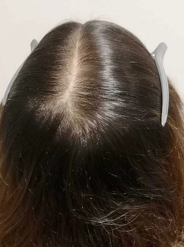 Center part after consistent use