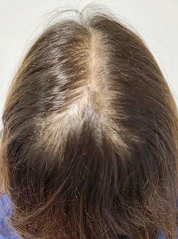Center part before consistent use